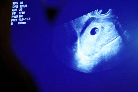 tagreuters.com2023binary_LYNXMPEJ4H02M-VIEWIMAGE